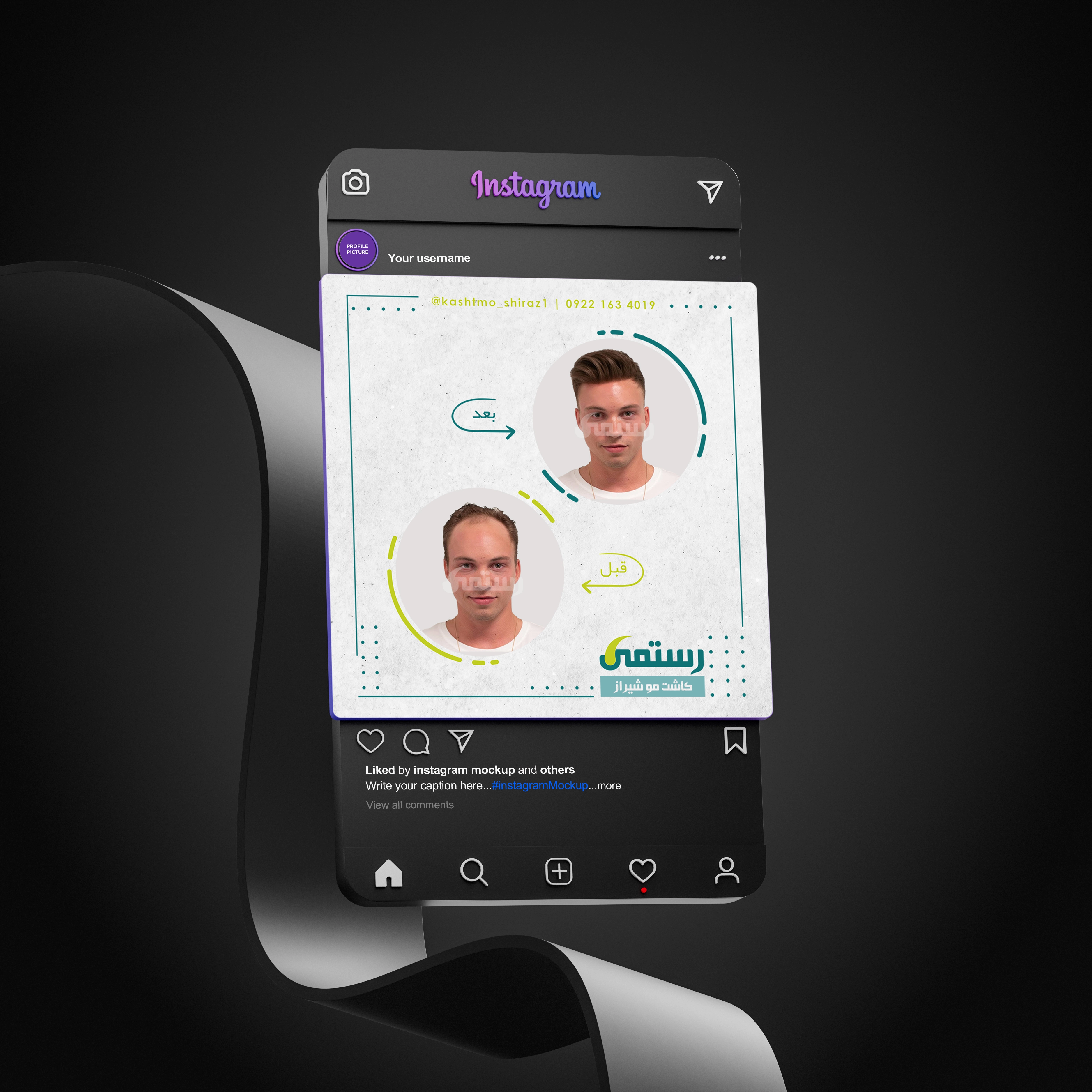 Rostami Hair Transplant